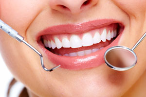 Is Teeth Whitening Permanent - Blog - Sparkle Dental - teeth-whitening